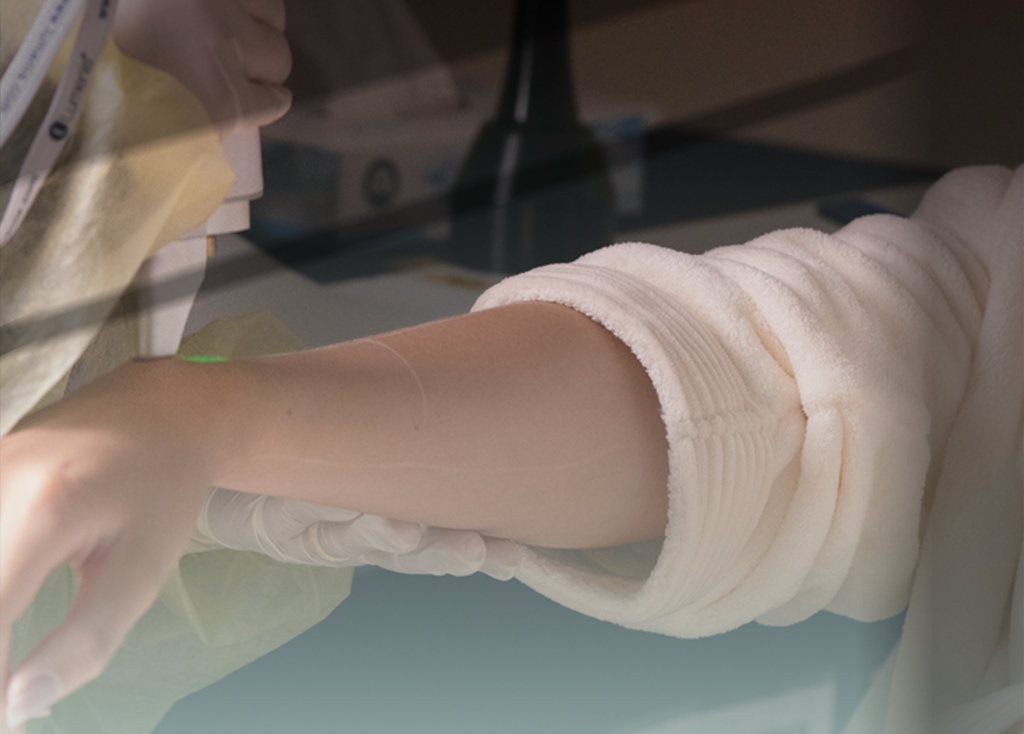 الليــــزر