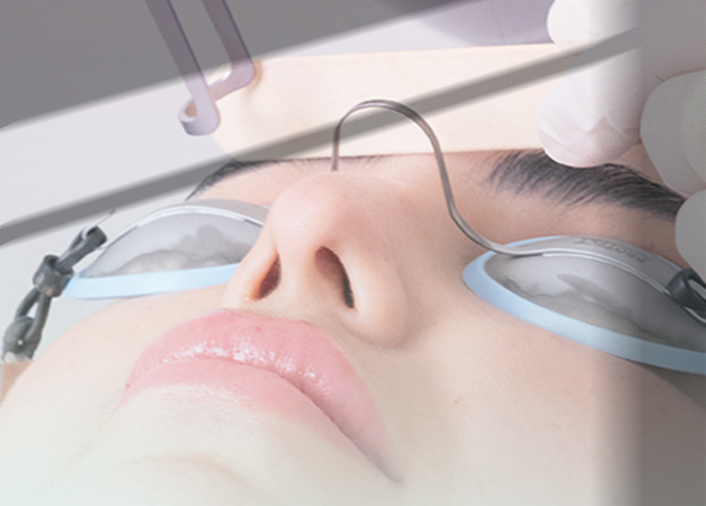 التشــقـــير